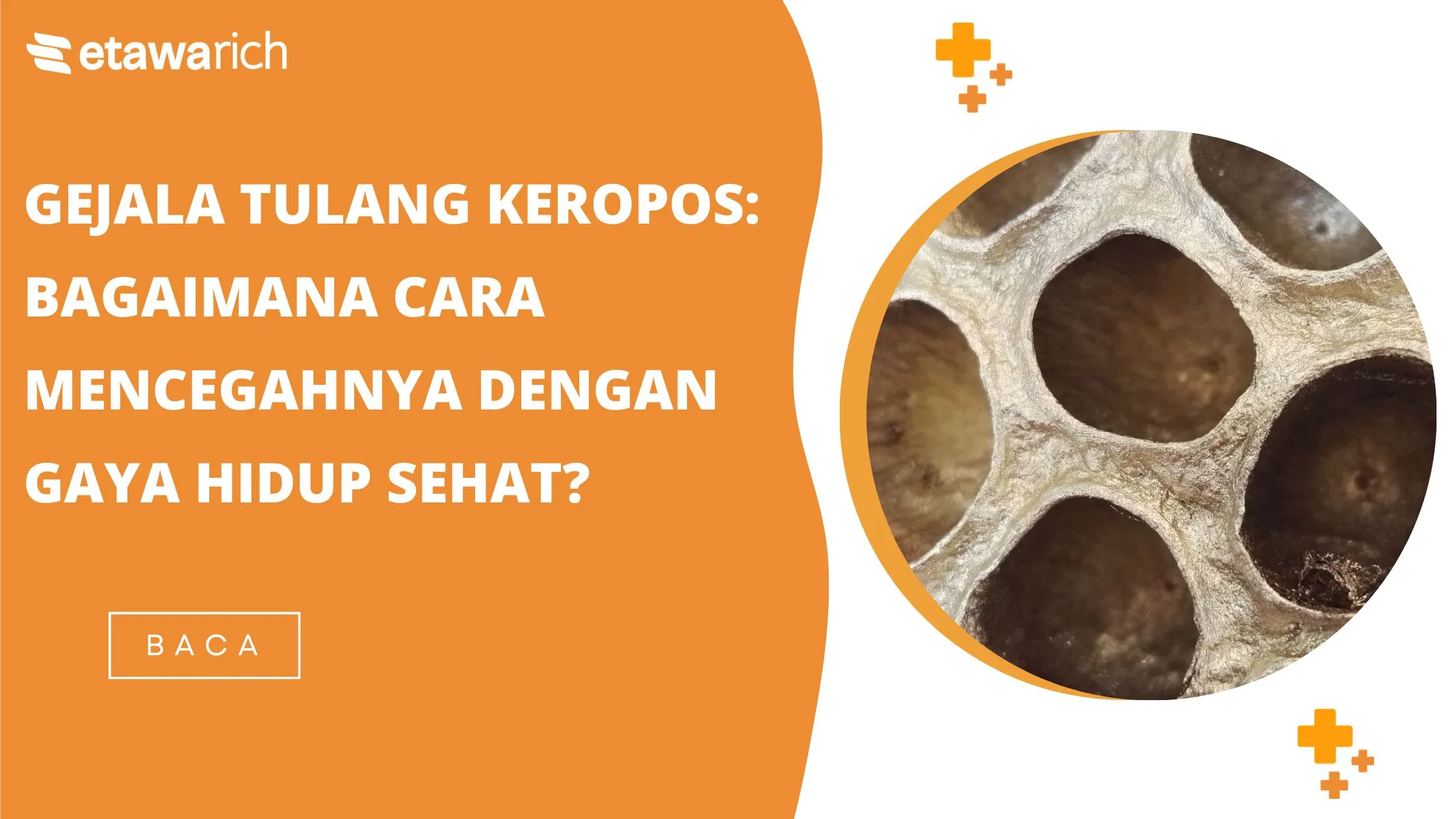 Gejala tulang keropos