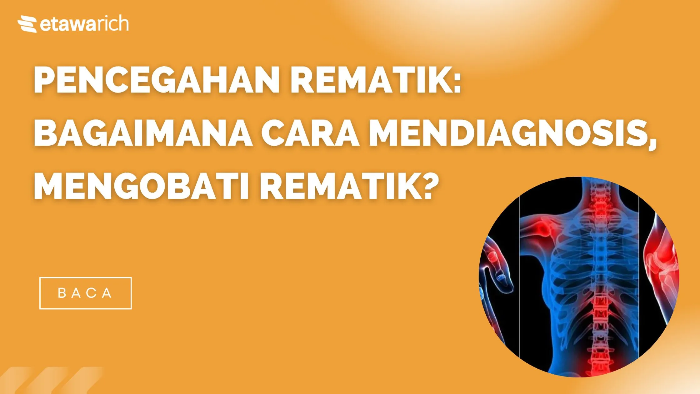 cara mencegah rematik