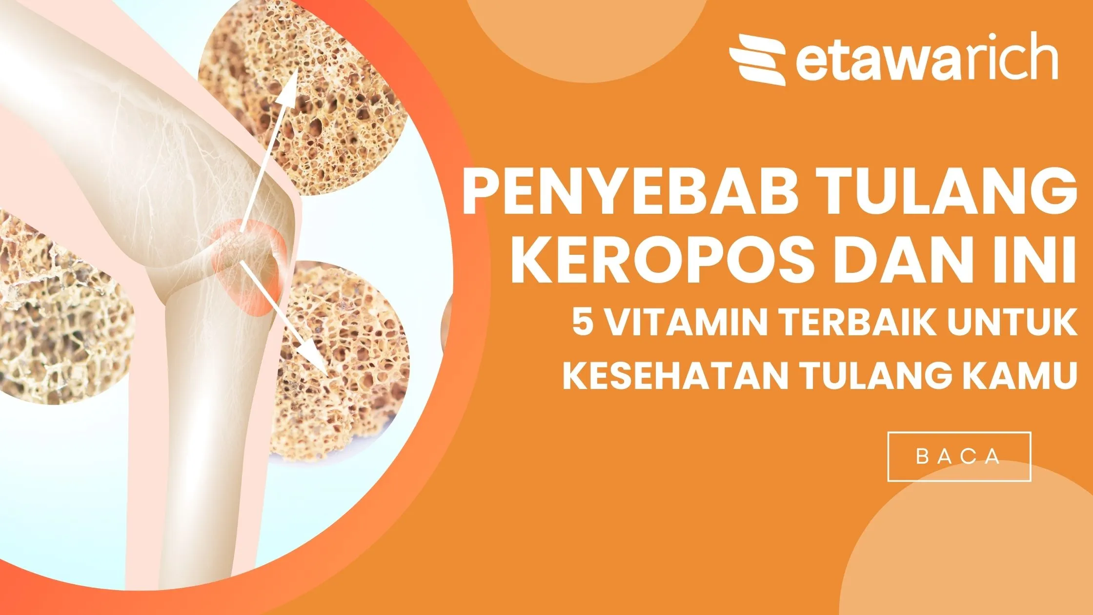 vitamin untuk kesehatan tulang