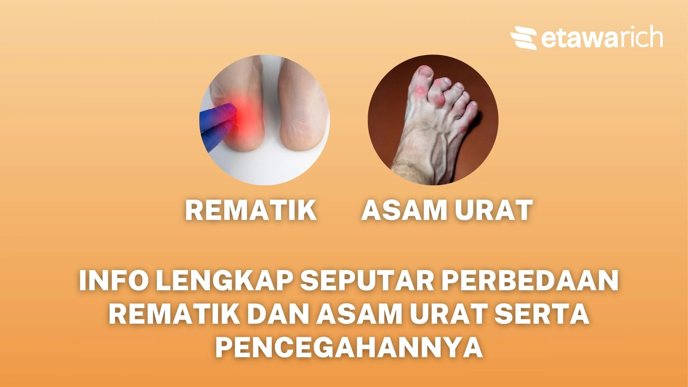 perbedaan rematik dan asam urat