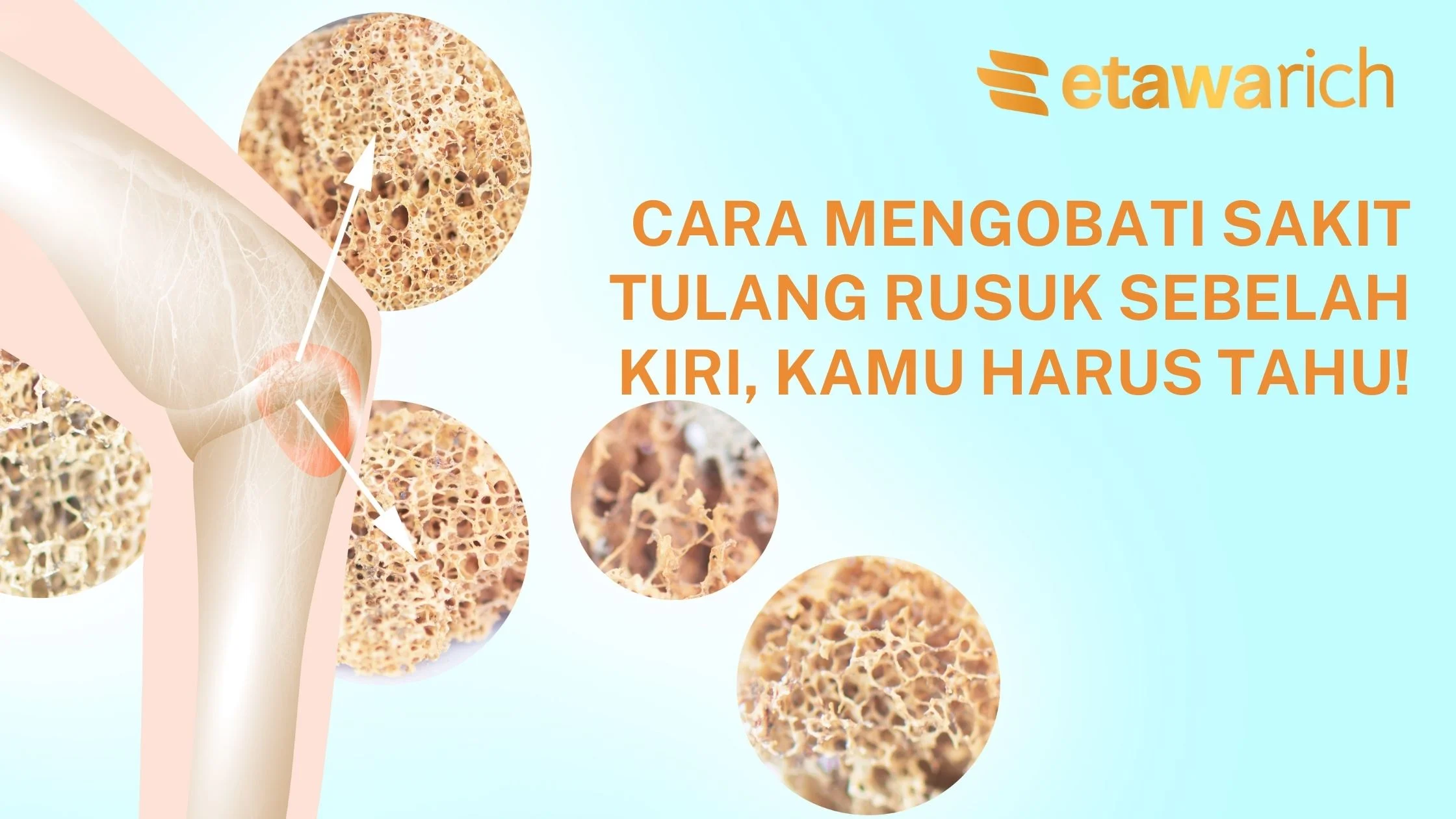 cara mengobati sakit tulang rusuk sebelah kiri